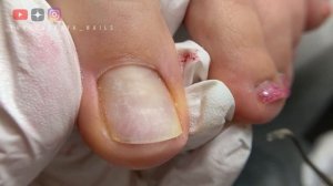 Нереальный Гель-лак. Педикюр с покрытием гель -лак #покрытие #гельлакмосква #гельлак #подология