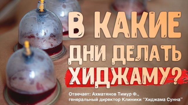 В какие дни делать Хиджаму? | Ахматянов Тимур | II Конференция специалистов по хиджаме