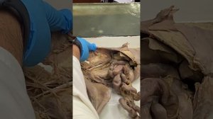 Нервы поясничной части пояснично-крестцового сплетения