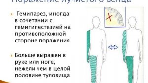 Механизмы клинических симптомов при поражении пирамидных путей