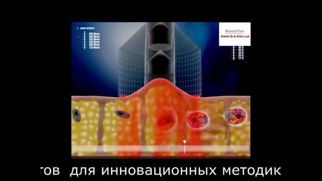 Косметологический аппарат для вакуумно роликового массажа смотреть онлайн