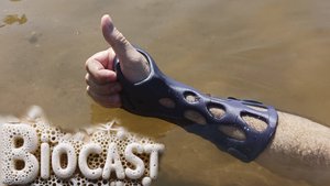 В ортезе BioCast на пляже