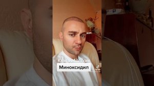 Миноксидил. Польза или вред? #миноксидил #пересадкаволос #krasav4ik #красавчик