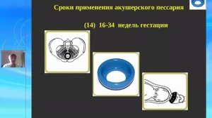 Черная Н. Е. Акушерский пессарий Доктора Арабин