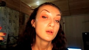 мезороллер