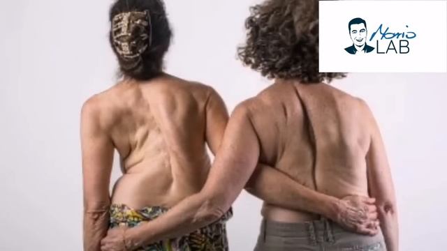 Najvažniji MINERAL za sprečavanje OSTEOPOROZE : TIHOG UBOJICE KOSTIJU! смотреть онлайн