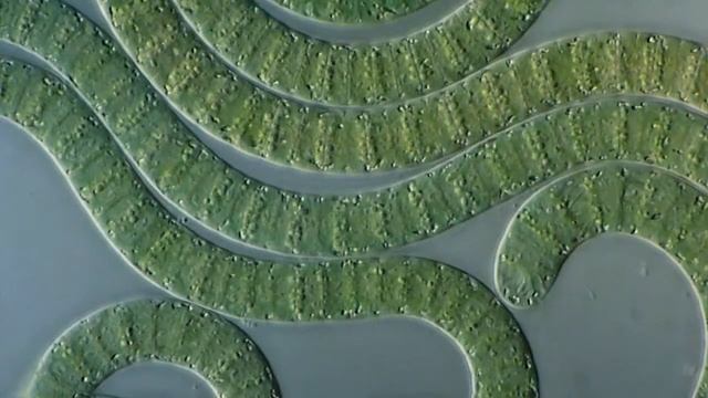 Цианобактерии/сине-зеленые водоросли под микроскопом [Cyanobacteria under microscope]