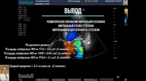 Ревматическое поражение митрального клапана. Митральный стеноз 2 степени. Способы определения МС.