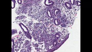 Менструальные изменения и основные ошибки в интерпретации