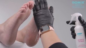 Жидкое лезвие и здоровье мастера: как кератолитик нового поколения влияет на него.