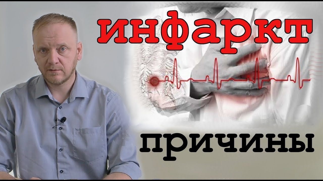 ИНФАРКТ миокарда: признаки, симптомы, лечение
