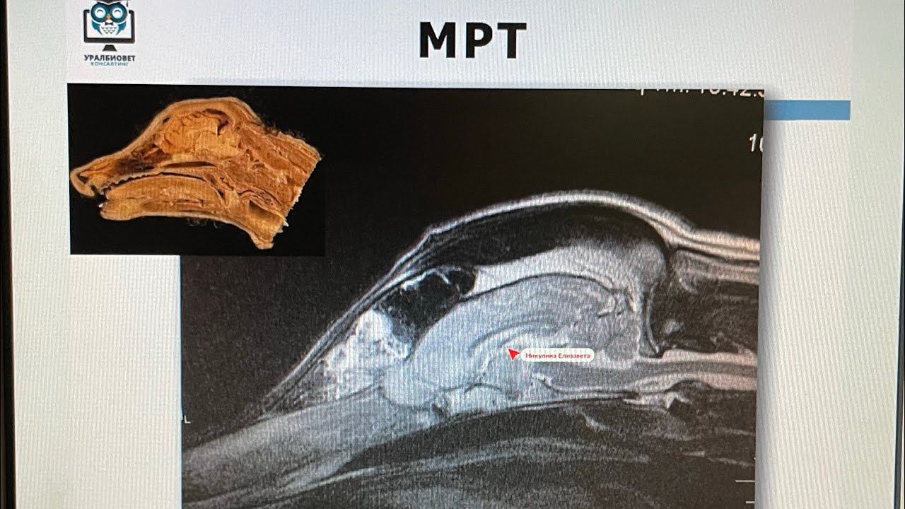 Никто вам по анализам и исследованиям ничего конкретного не скажет. (?)