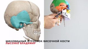 Топография черепа. Костные ориентиры на голове. Анатомия черепа 3D