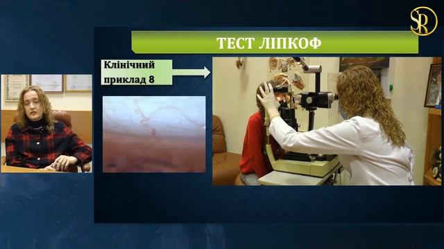КРАСНЫЙ ГЛАЗ Мастер класс И.Шаргородская ССГ Красные глаза почему? ПРИЧИНЫ И ЧТО ДЕЛАТЬ/С.Риков vlo