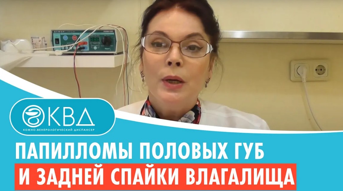? Папилломы половых губ и задней спайки влагалища. Клинический случай №599