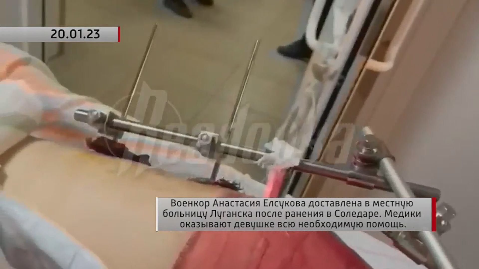 Анастасия Елсукова доставлена в больницу Луганска после ранения в Соледаре. Актуально. 20.01.2023