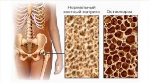 Опора и движение.  Кости скелета