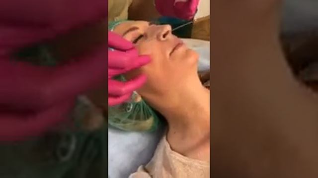 Профилактика формирования брыль и морщин марионетки смотреть онлайн