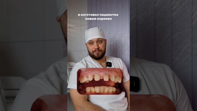 Тотальное протезирование коронками. Смотрите, как это было👇🏼 #стоматология #протезирование