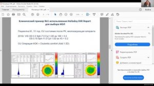 Различные подходы к зрительной реабилитации пациентов после радиальной кератотом.mp4