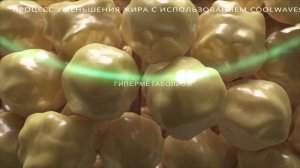 Новый методе коррекции фигуры в АРклиник - микроволновой липолиз