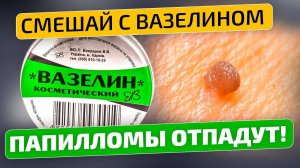 Папилломы, бородавки и другие наросты на теле боятся этого чудо средства!