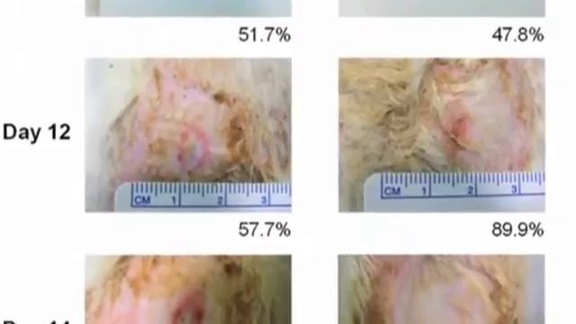 Заживляющий раны наногель представили сингапурские учёные(новости) http://9kommentariev.ru/ смотреть онлайн