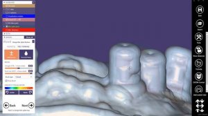 Exocad индивидуальная ложка. Видеоинструкция