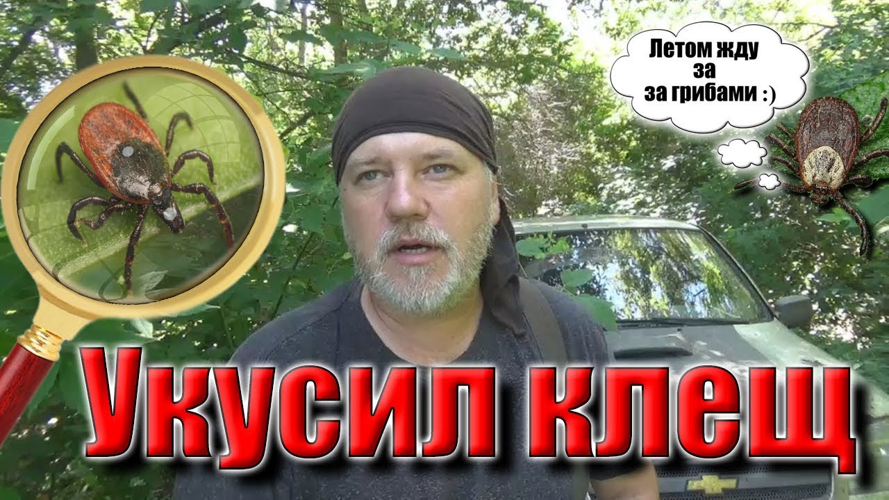 Укусил?клещ! Как вытащить клеща и какие последствия! Was bitten by a tick!.