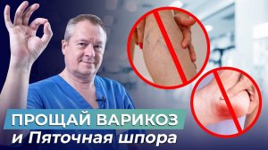 Осторожно, ПЯТОЧНАЯ ШПОРА! Как СНЯТЬ ОСТРУЮ БОЛЬ и даже УБРАТЬ ВАРИКОЗ за 2 месяца?