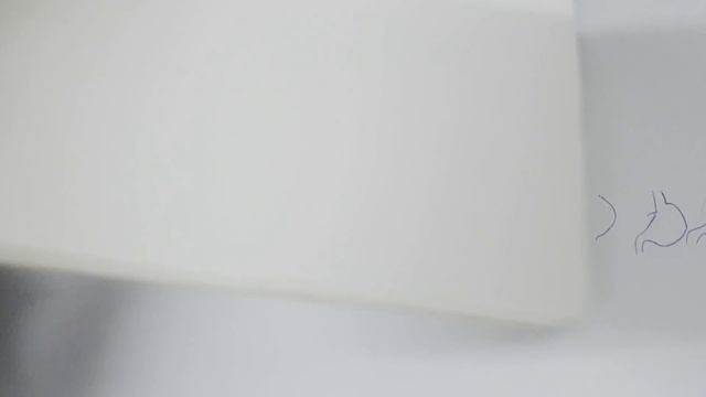 Embryological development of GIT|Anomalies of Foregut |part =01 Foregut| смотреть онлайн