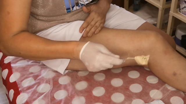 Как я удаляю себе волосы Сахарной Пастой. Шугаринг на ногах шпателем.