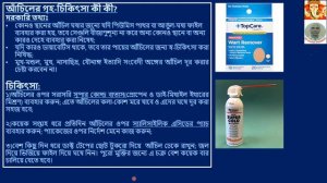 আঁচিলের প্রধান ১০টি হোমিপ্যাথিক ওষুধ । TOP 10 HOMEOPATHIC REMEDIES FOR WARTS in Bangla