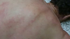 СТАРИННАЯ ТЕХНИКА. Медовый массаж 2