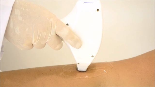 Laser Diodo - IMG Galaxy 808 смотреть онлайн