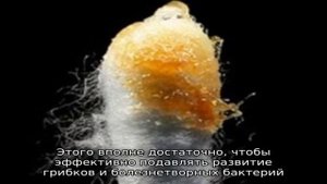 Сера в ушах