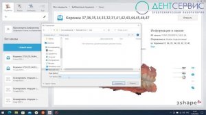 Oтправка цифровых оттисков в зуботехническую лабораторию со сканера 3shape