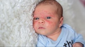 АДАПТАЦИЯ НОВОРОЖДЕННОГО РЕБЕНКА К ВНЕУТРОБНОЙ ЖИЗНИ | Пограничные состояния новорожденных