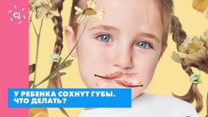 У ребенка сохнут губы. Что делать?