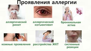 Осторожно, АЛЛЕРГИЯ!, Сыпь. Причины и лечение.