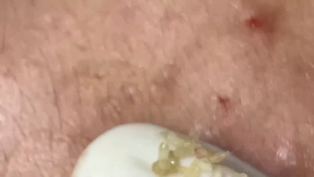 Enjoy Every Day With The Best Video Loan Nguyen Spa Official 2653 смотреть онлайн