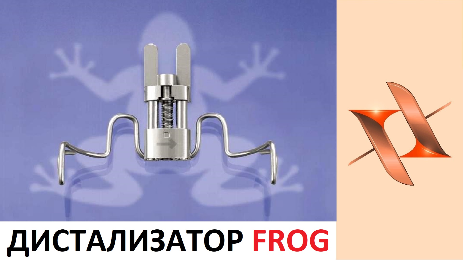 Ортоднтический аппарат Frog (Лягушка)