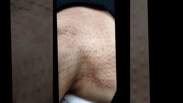 Уход за кожей шеи #косметолог #kosmetologia #тошкент #топ #аёллар #turkey #мезотерапия #омоложение смотреть онлайн