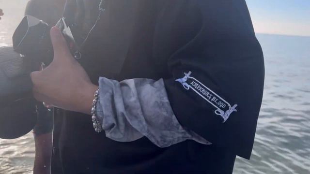 Сломал ногу походу… смотреть онлайн