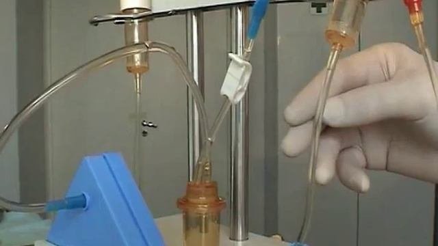 Аппаратный плазмаферез часть2 рекомендации для врачей
