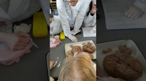 Извилины головного мозга. АНАТОМИЯ ЦНС