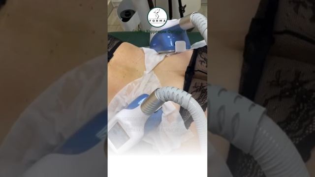 #криолиполиз в Студии Коррекции Фигуры «FORMA», ☎️ 8 916 000 16 17, Москва, Митино, Ⓜ️Волоколамская смотреть онлайн