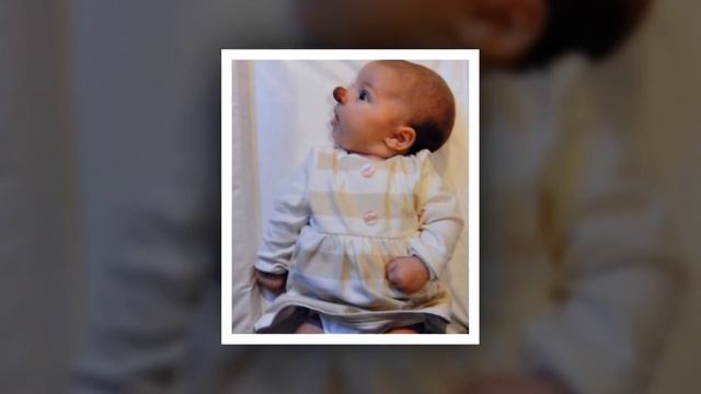 Самые необычные родинки ТОП 5 смотреть онлайн