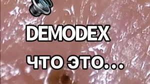 Demodex - что это такое ?