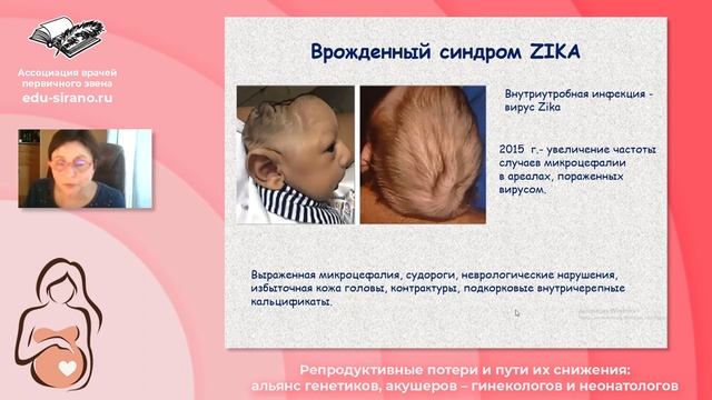 7.12.2021 Врожденные пороки развития: классификация, этиология, профилактика. смотреть онлайн